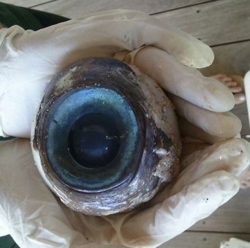 Giant Eyeball